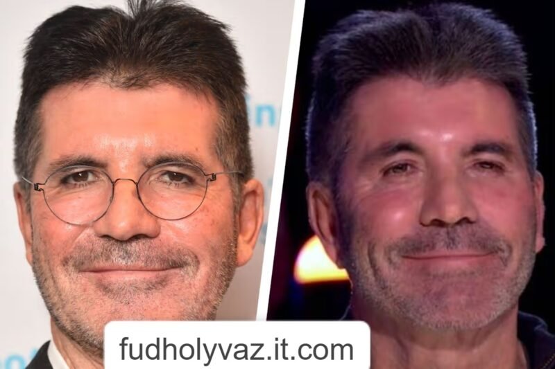 Simon Cowell Plastic Surgery: The Real Story Behind His Changing Look